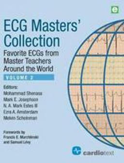 Ecg Masters' Collection Ecg Masters' Collection