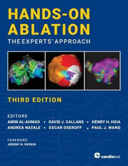 Hands-On Ablation, Third Edition