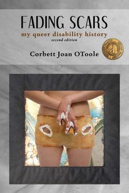 Fading Scars My Queer Disability History, 2nd Edition 2nd 9781947647183 Front Cover