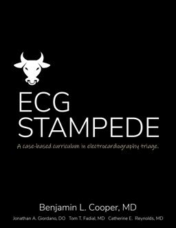 ECG Stampede ECG Stampede