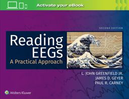 Reading EEGs: a Practical Approach
