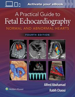 Practical Guide to Fetal Echocardiography Normal and Abnormal Hearts 4th 9781975126810 Front Cover