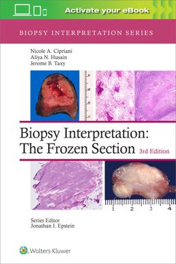 Biopsy Interpretation: the Frozen Section: Print + EBook with Multimedia 3rd 9781975170073 Front Cover