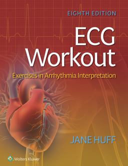ECG Workout Exercises in Arrhythmia Interpretation 8th 9781975174545 Front Cover