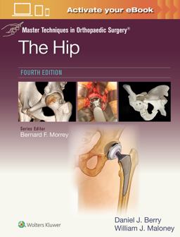 Master Techniques in Orthopaedic Surgery: the Hip: Print + EBook with Multimedia