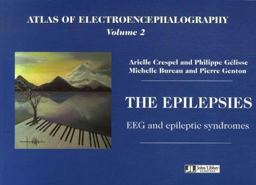 Atlas of Electroencephalography, Volume 2