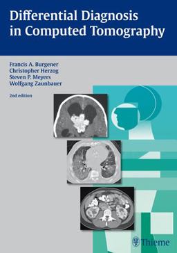 Differential Diagnosis in Computed Tomography 2nd 9783131025425 Front Cover