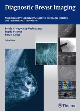 Diagnostic Breast Imaging Mammography, Sonography, Magnetic Resonance Imaging, and Interventional Procedures 3rd 9783131028938 Front Cover