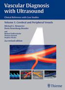 Vascular Diagnosis with Ultrasound Clinical Reference with Case Studies Volume 1: Cerebral and Peripheral Vessels 2nd 9783131038326 Front Cover
