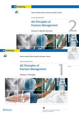 AO Principles of Fracture Management Specific Fractures 2nd 9783131174420 Front Cover