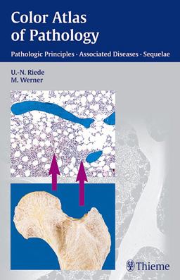 Color Atlas of Pathology Pathologic Principles, Associated Diseases, Sequela  9783131277817 Front Cover