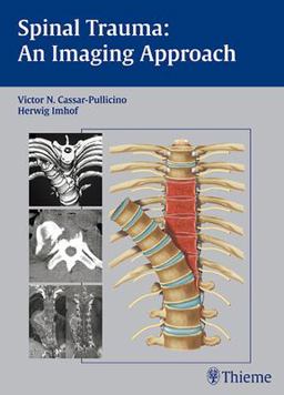 Spinal Trauma An Imaging Approach  9783131374714 Front Cover