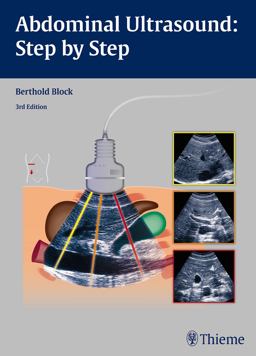 Abdominal Ultrasound: Step by Step 3rd 9783131383631 Front Cover