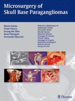 Microsurgery of Skull Base Paragangliomas  9783131486110 Front Cover
