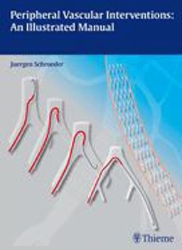 Trainer Vaskulï¿½re Interventionen  9783131697516 Front Cover