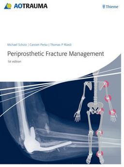 Periprosthetic Fracture Management  9783131715111 Front Cover