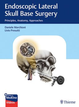 Endoscopic Lateral Skull Base Surgery Principles, Anatomy, Approaches  9783132412774 Front Cover