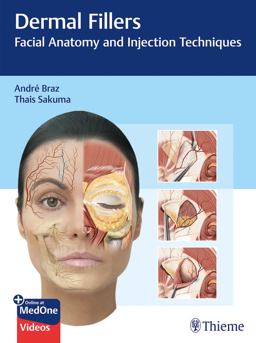 Atlas de Anatomia e Preenchimento Global de Face  9783132427723 Front Cover