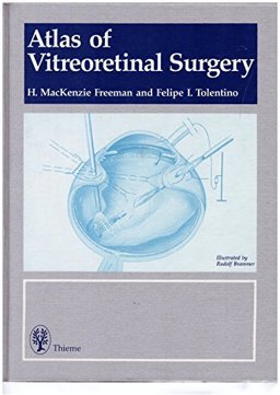 Atlas of Vitreorentinal Surgery