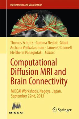 Computational Diffusion MRI and Brain Connectivity