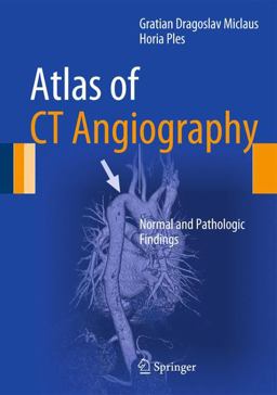 Atlas of CT Angiography Normal and Pathologic Findings 2014 9783319052847 Front Cover