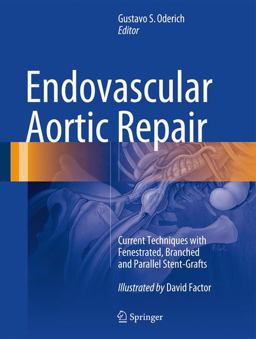 Endovascular Aortic Repair Current Techniques with Fenestrated, Branched and Parallel Stent-Grafts  9783319151915 Front Cover