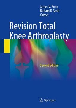 Revision Total Knee Arthroplasty 2nd 9783319673424 Front Cover