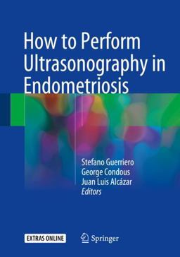 How to Perform Ultrasonography in Endometriosis  9783319711379 Front Cover