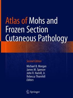Atlas of Mohs and Frozen Section Cutaneous Pathology 2nd 9783319748467 Front Cover