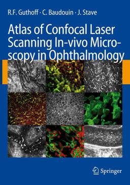 Atlas of Confocal Laser Scanning In-Vivo Microscopy in Ophthalmology Principles and Applications in Diagnostic and Therapeutic Ophtalmology  9783540327059 Front Cover