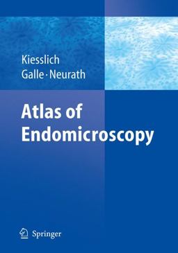 Atlas of Endomicroscopy  9783540347576 Front Cover