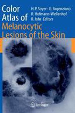 Color Atlas of Melanocytic Lesions of the Skin  9783540351054 Front Cover