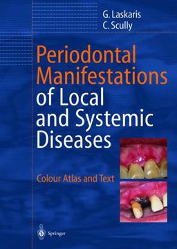 Periodontal Manifestations of Local and Systemic Diseases  9783540432494 Front Cover