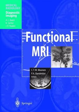 Functional MRI