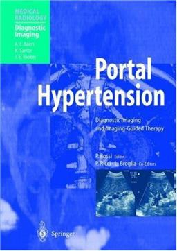 Portal Hypertension