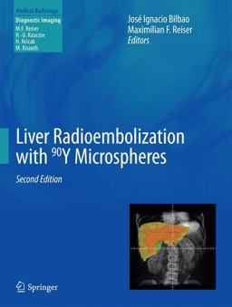 Liver Radioembolization with 90Y Microspheres 2nd 9783642364723 Front Cover