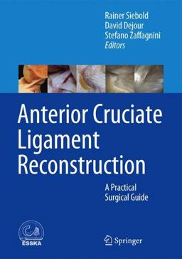 Arthroscopic Anterior Cruciate Ligament Reconstruction