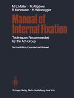 Manual of Internal Fixation