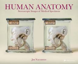 Human Anatomy Stereoscopic Images of Medical Specimens  9783791383293 Front Cover