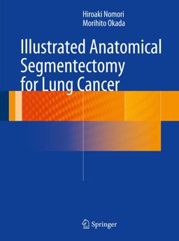 Illustrated Anatomical Segmentectomy for Lung Cancer:  9784431541431 Front Cover