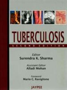 Tuberculosis