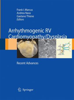 Arrhythmogenic RV Cardiomyopathy/Dysplasia Recent Advances  9788847056213 Front Cover