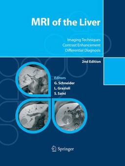 MRI of the Liver MRI of the Liver
