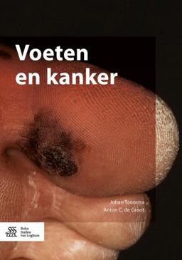 Voeten en Kanker