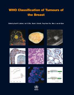 WHO Classification of Tumours of the Breast 4th 9789283224334 Front Cover