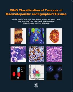 WHO Classification of Tumours of Haematopoietic and Lymphoid Tissues 4th 9789283244943 Front Cover