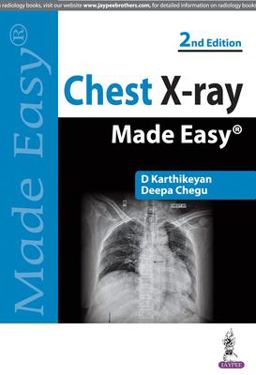 Chest X-Ray Made Easy 2nd 9789350255636 Front Cover