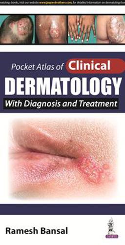 Pocket Atlas of Clinical Dermatology  9789351527688 Front Cover