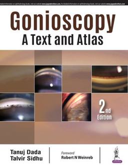 Gonioscopy: a Text and Atlas 2nd 9789352701520 Front Cover