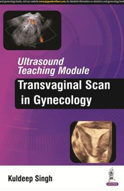 Ultrasound Teaching Module: Transvaginal Scan in Gynecology  9789385999260 Front Cover